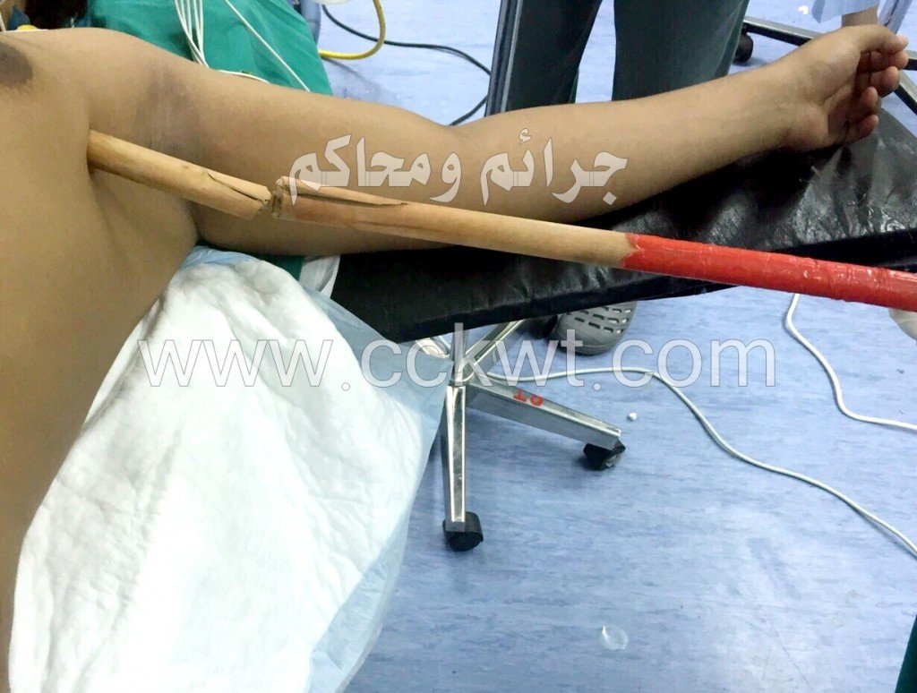 حادثة غريبة